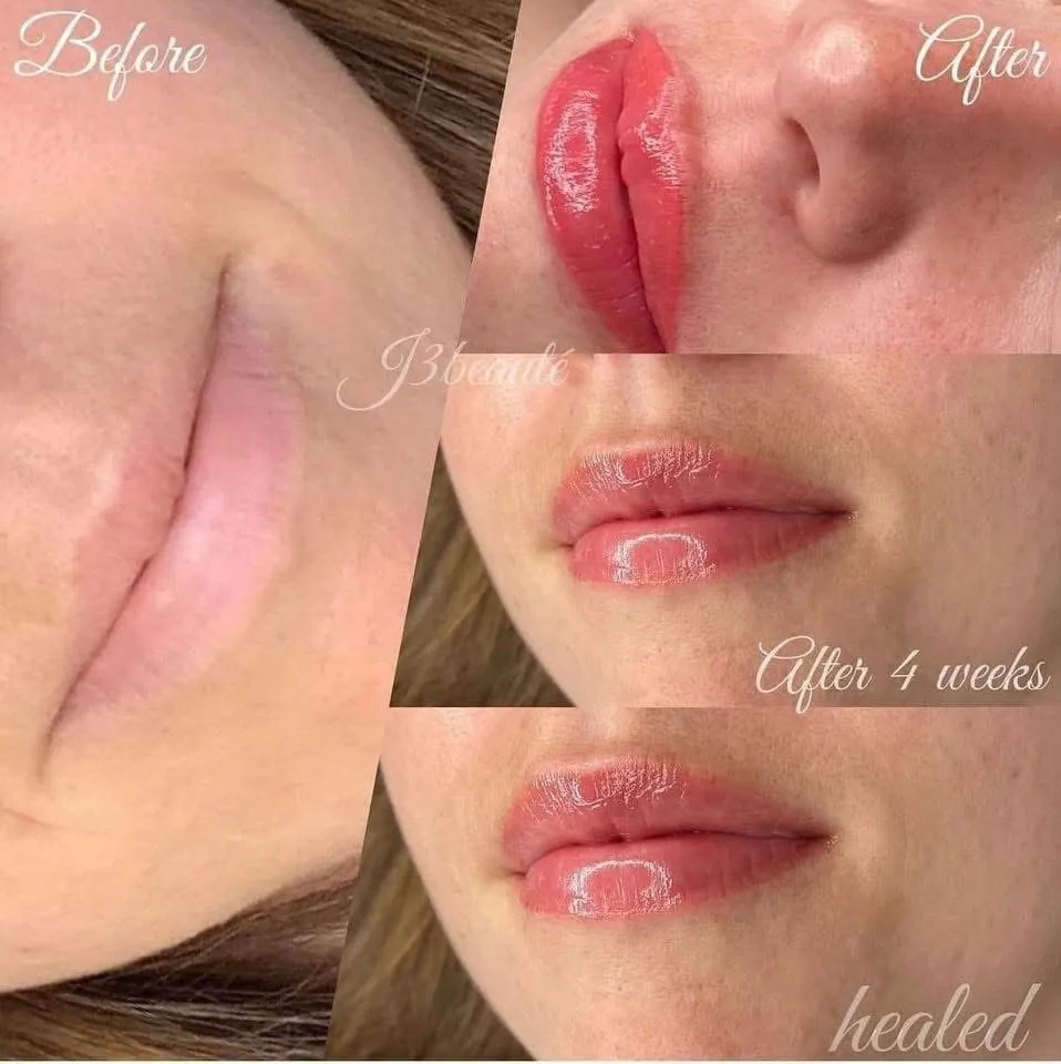 Avant / après lip blush