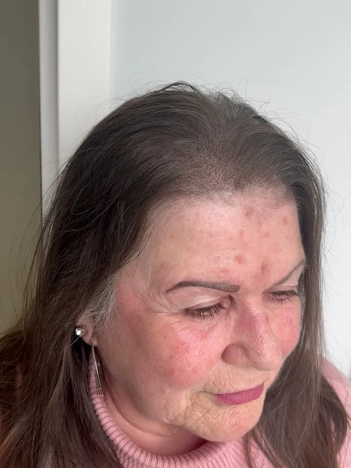 Soin hydratant du visage