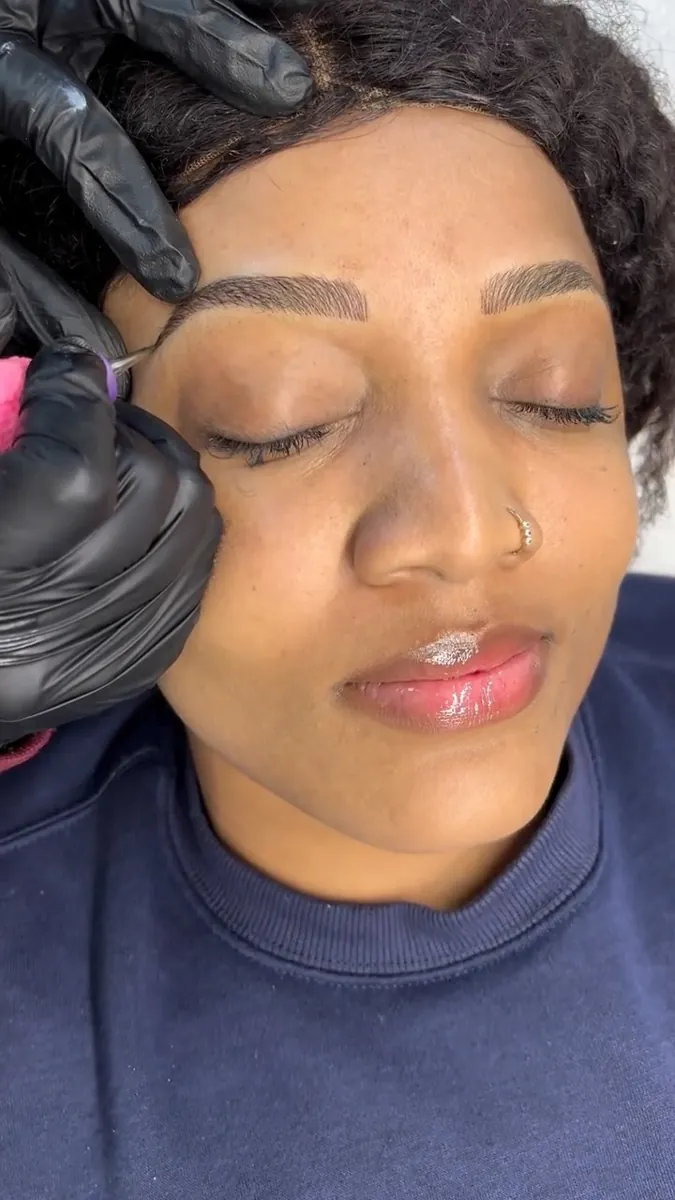 Restructuration des sourcils