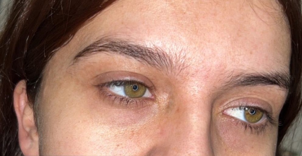 Avant — sourcils clairsemés